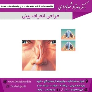 جراحی انحراف بینی