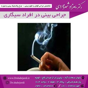 جراحی بینی در افراد سیگاری