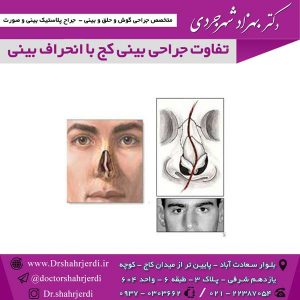 تفاوت جراحی بینی کج با انحراف بینی 