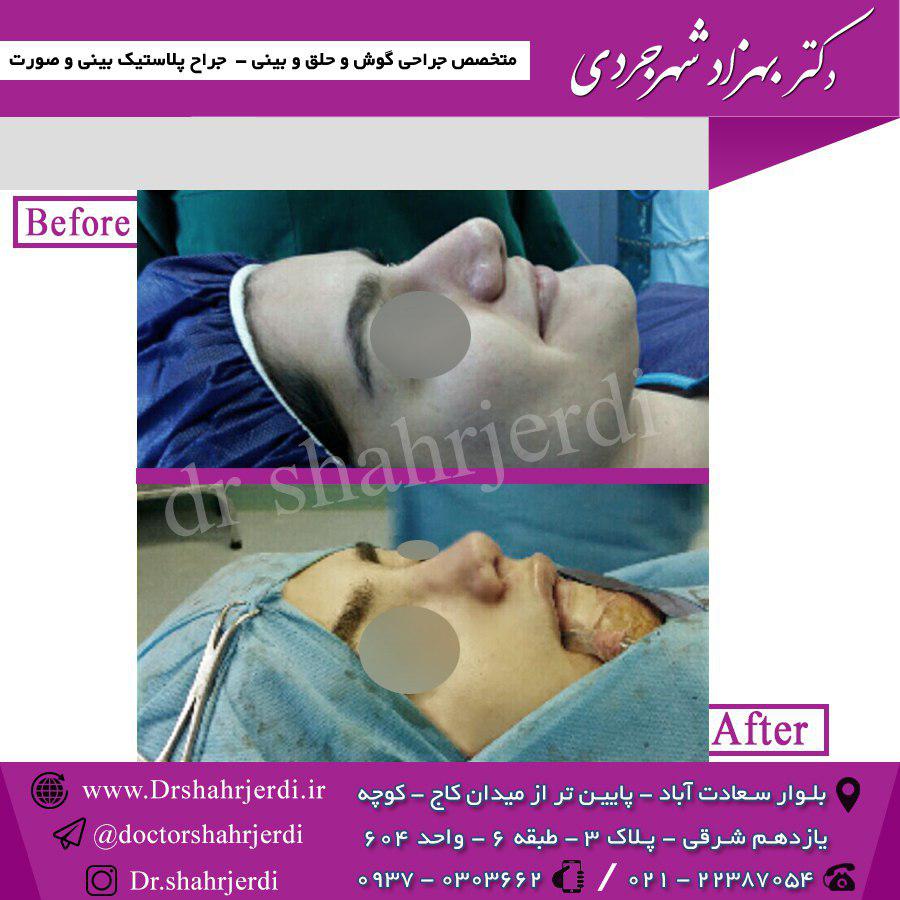 عمل دماغ