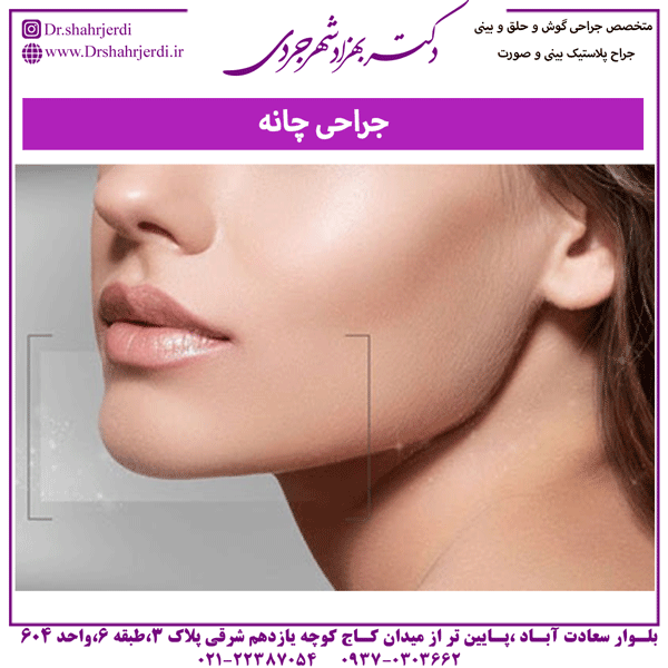جراحی چانه