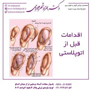 اقدامات قبل از اتوپلاستی