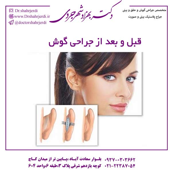 قبل و بعد از جراحی گوش