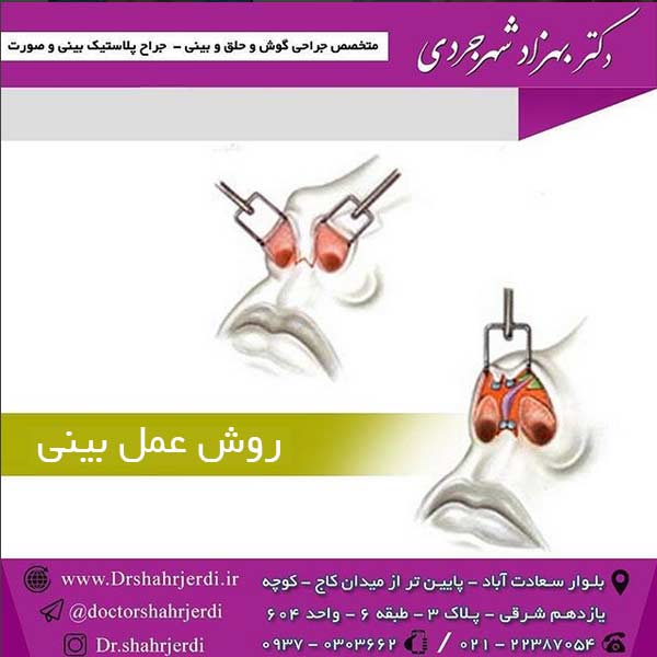 روش عمل بینی