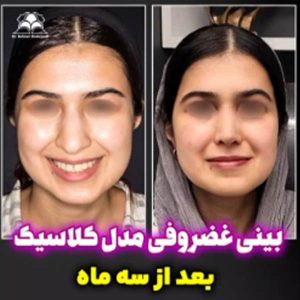 جراحی بینی - دکتر بهزاد شهرجردی