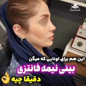 جراحی بینی - دکتر بهزاد شهرجردی