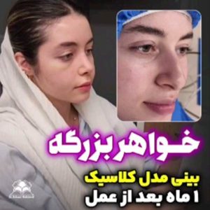 جراحی بینی - دکتر بهزاد شهرجردی