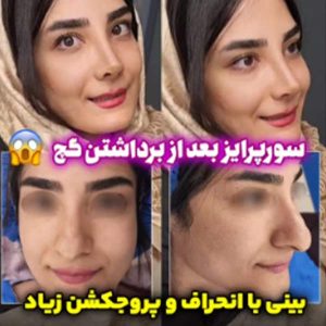 جراحی بینی - دکتر بهزاد شهرجردی