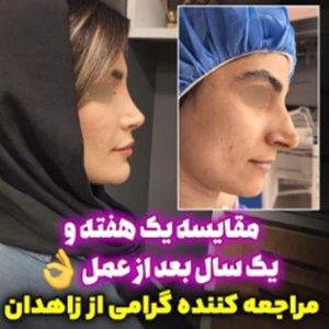 جراحی بینی - دکتر بهزاد شهرجردی