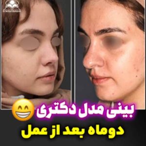 جراحی بینی - دکتر بهزاد شهرجردی