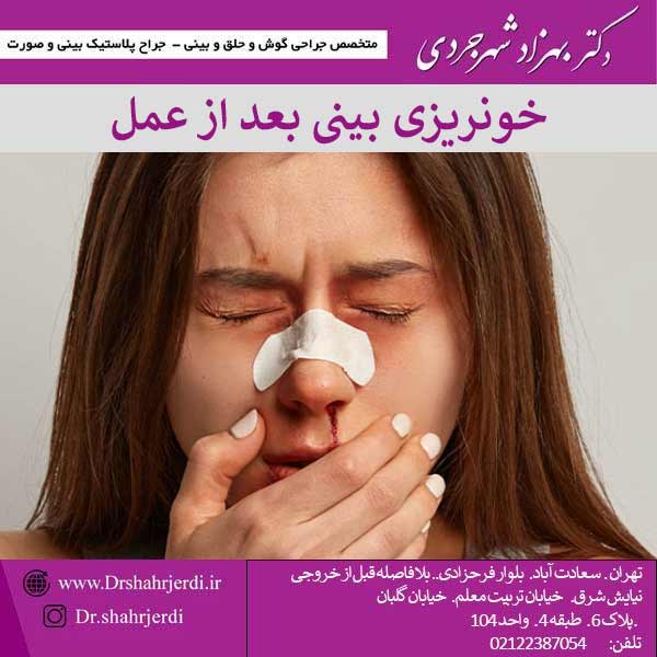 خونریزی بینی بعد از عمل