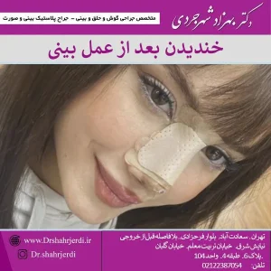 عوارض خندیدن بعد از عمل بینی + تا چند وقت نخندیم؟ دکتر بهزاد شهرجردی