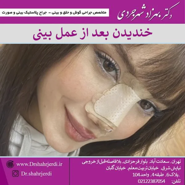 عوارض خندیدن بعد از عمل بینی + تا چند وقت نخندیم؟ دکتر بهزاد شهرجردی