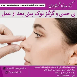 بی حسی و گز گز نوک بینی از عمل - دکتر بهزاد شهرجردی
