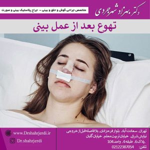 تهوع بعد از عمل بینی